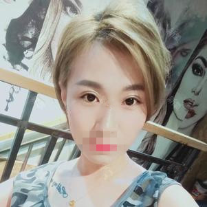 上海臻景醫(yī)療整形醫(yī)生李載成做雙眼皮怎么樣？李載成雙眼皮手術(shù)案例