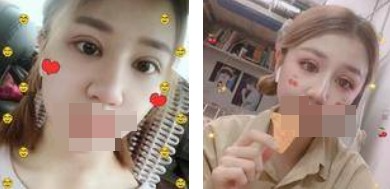 做了全切雙眼皮不僅外表變美了，內(nèi)心也更加自信了
