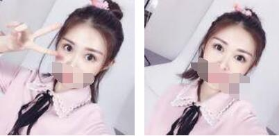 沒(méi)有了眼袋困擾，身體和心態(tài)都年輕了十歲