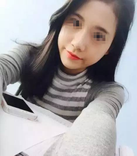 做完膨體隆鼻，鼻子變“挺”了