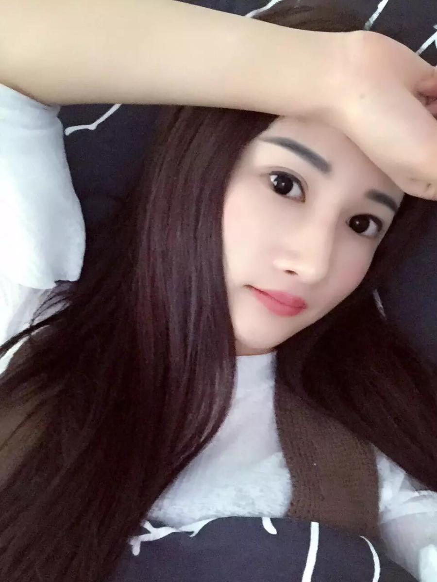 廣州廣大整形醫(yī)生秦瑜做顴骨內(nèi)推+下頜角整形怎么樣？附案例