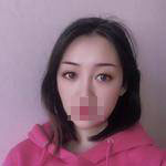 做完雙眼皮手術(shù)眼睛更加迷人了，眼睛自己會撩小哥哥