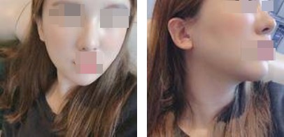 恢復(fù)過程