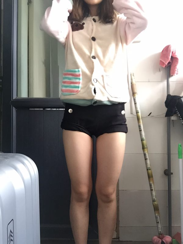 成都美立方整形醫(yī)院黃華醫(yī)生做大腿吸脂怎么樣？附大腿吸脂案例