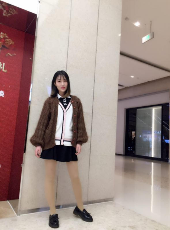 成都美立方整形醫(yī)院黃華醫(yī)生做大腿吸脂怎么樣？附大腿吸脂案例