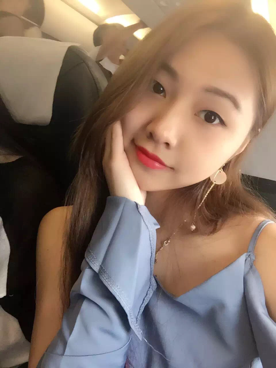 廣州中科美整形醫(yī)生徐長亮做切開雙眼皮怎么樣？附切開雙眼皮案例