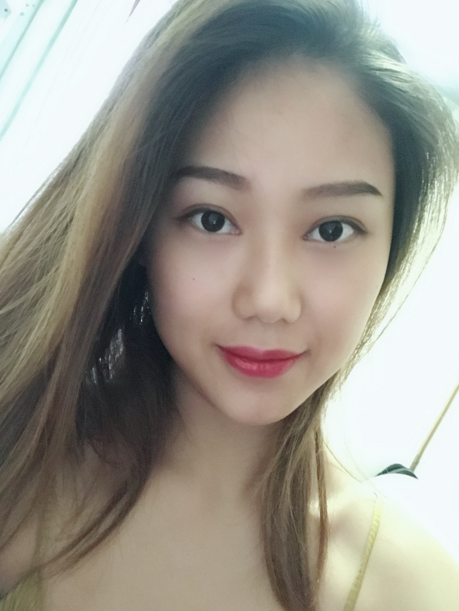 西安藝星整形醫(yī)院徐智慧醫(yī)生做埋線(xiàn)提升怎么樣？附西安藝星埋線(xiàn)提升案例