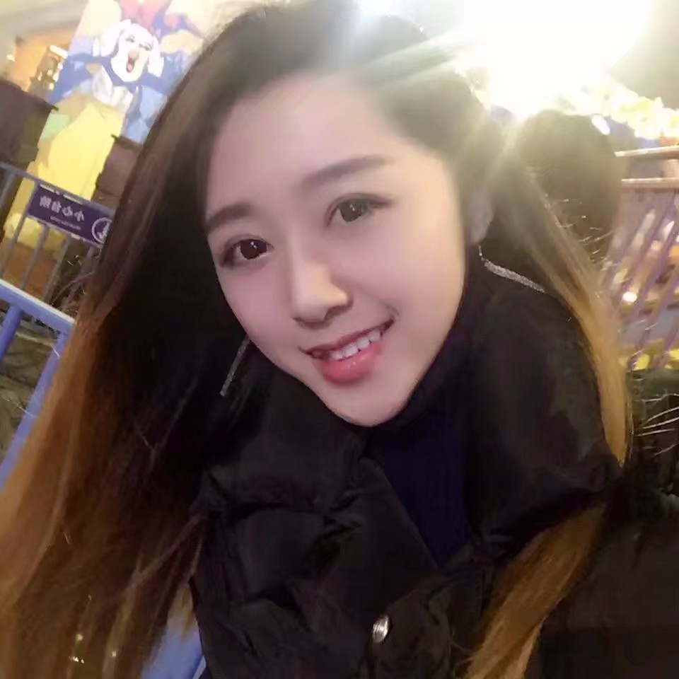 西安米蘭柏羽整形醫(yī)院李旭平做切開雙眼皮效果怎么樣？附案例