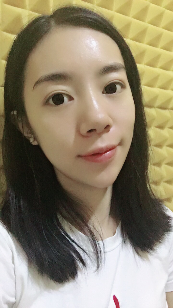 做完祛眼袋手術(shù)7天