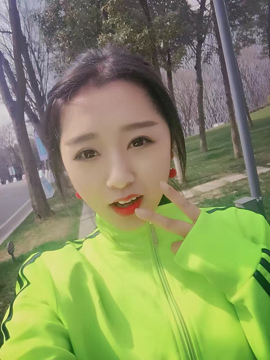 西安米蘭柏羽整形醫(yī)院李旭平做切開雙眼皮效果怎么樣？附案例