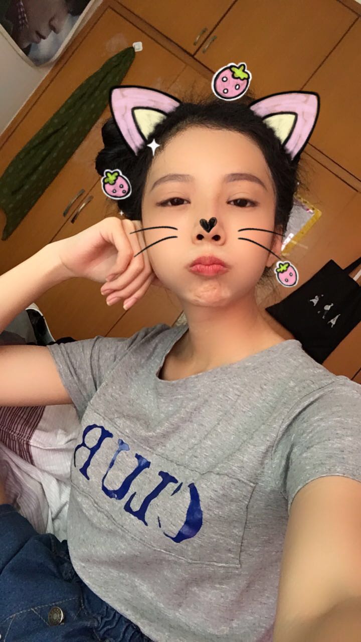 西安高一生醫(yī)療美容醫(yī)院網(wǎng)購(gòu)恒醫(yī)生做自體脂肪全臉填充案例效果對(duì)比圖