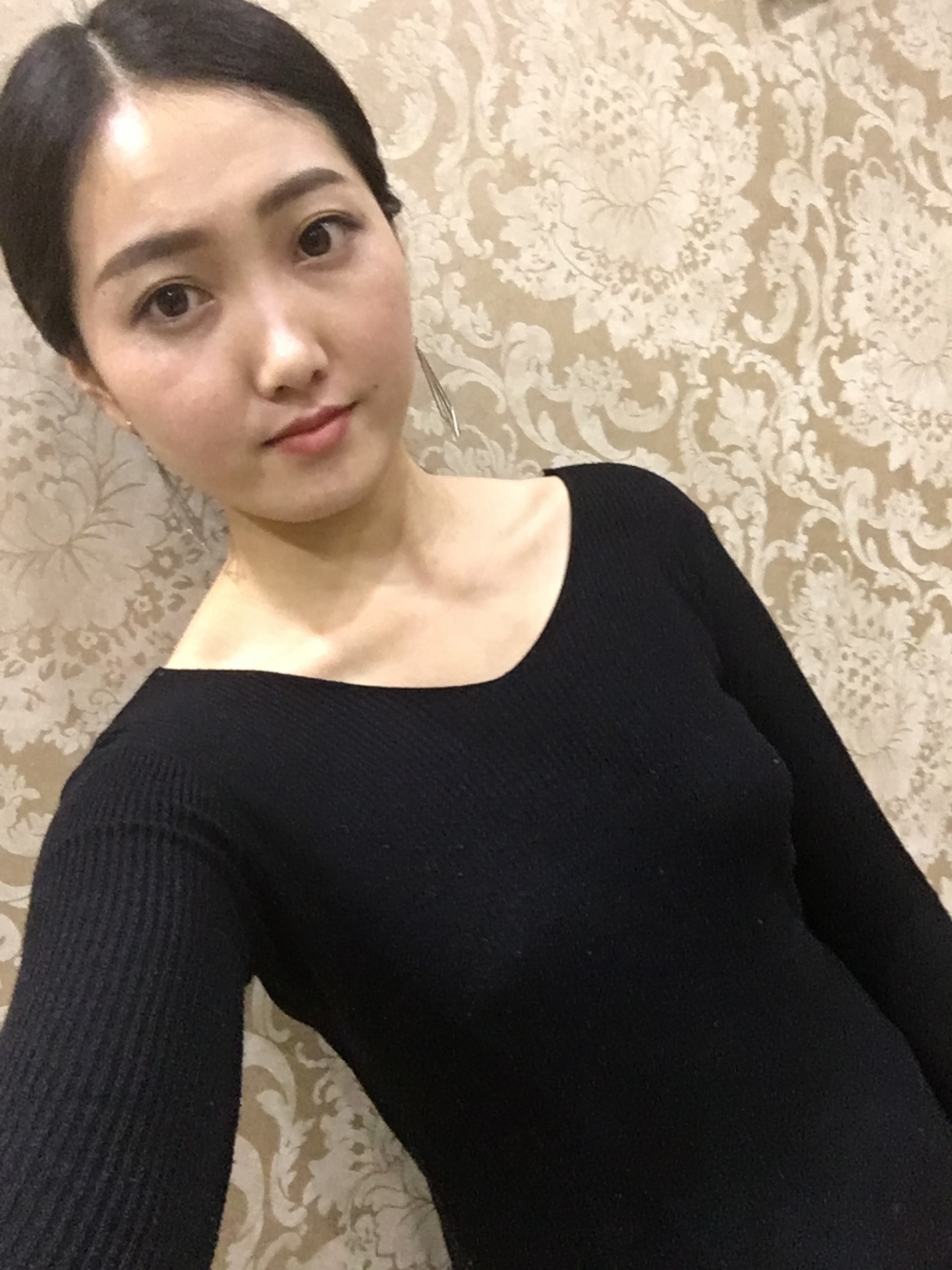 宜春美萊醫(yī)療整形醫(yī)生黃治林做自體脂肪隆胸怎么樣？附案例
