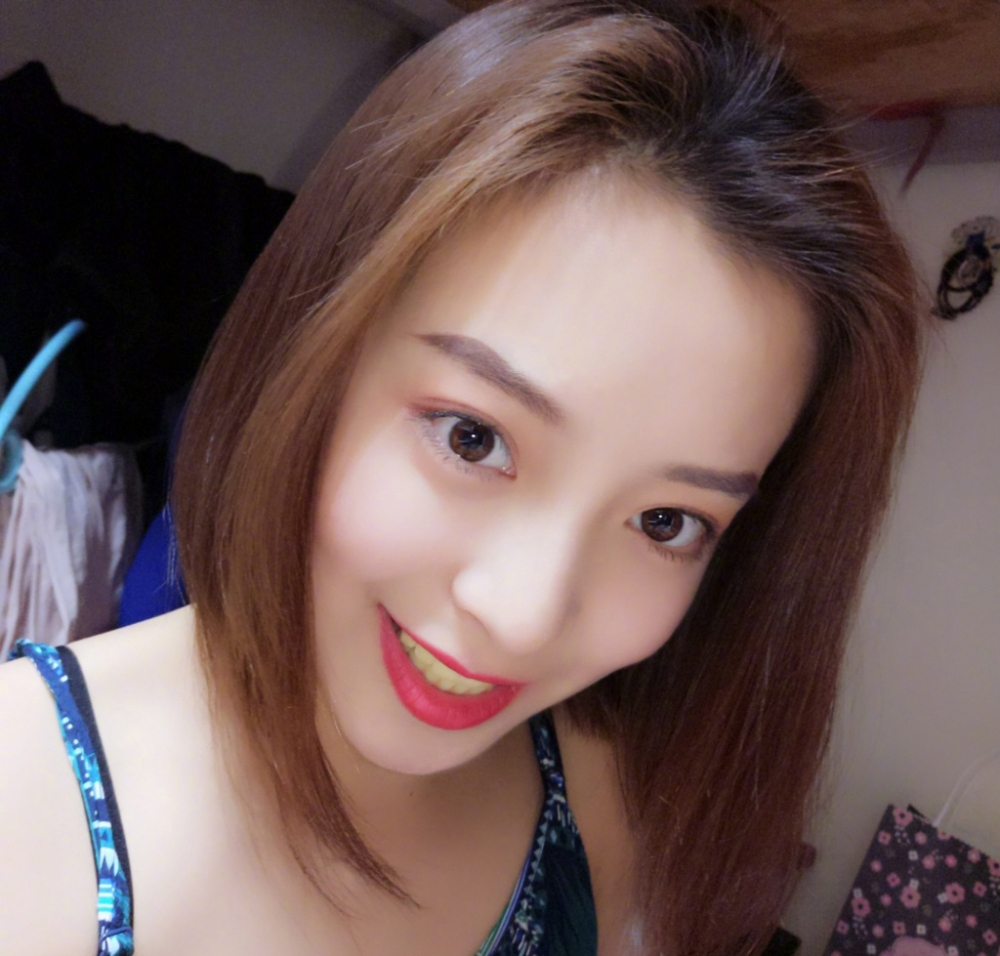 重慶樂樂欣口腔趙麗麗醫(yī)生做冷光美白效果怎么樣？附冷光美白效果對比圖