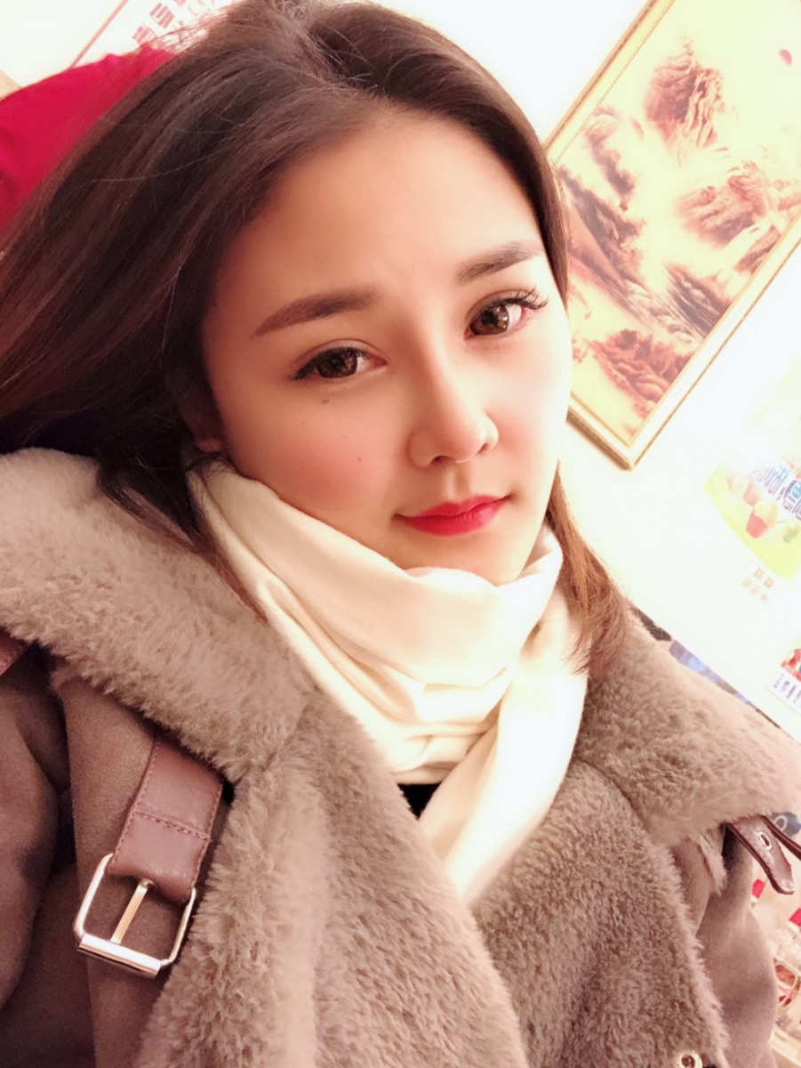 鄭州華領(lǐng)醫(yī)療美容醫(yī)院賀小虎醫(yī)生做眼綜合+鼻部整形手術(shù)效果怎么樣？