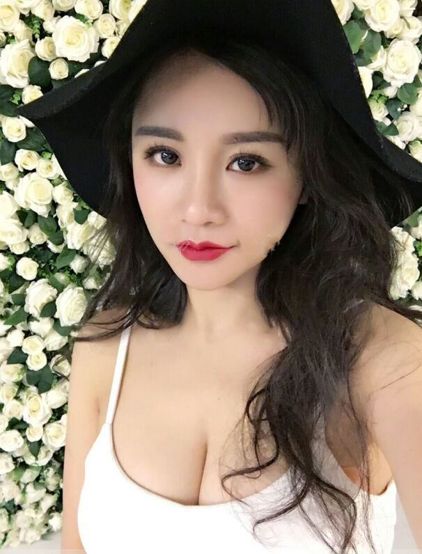 海南韓美醫(yī)學(xué)美容醫(yī)院李強(qiáng)醫(yī)生做自體脂肪隆胸效果怎么樣？附案例
