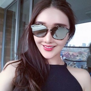 廣州柏德口腔蘭海龍醫(yī)生做瓷貼面效果怎么樣？廣州柏德口腔瓷貼面案例分享