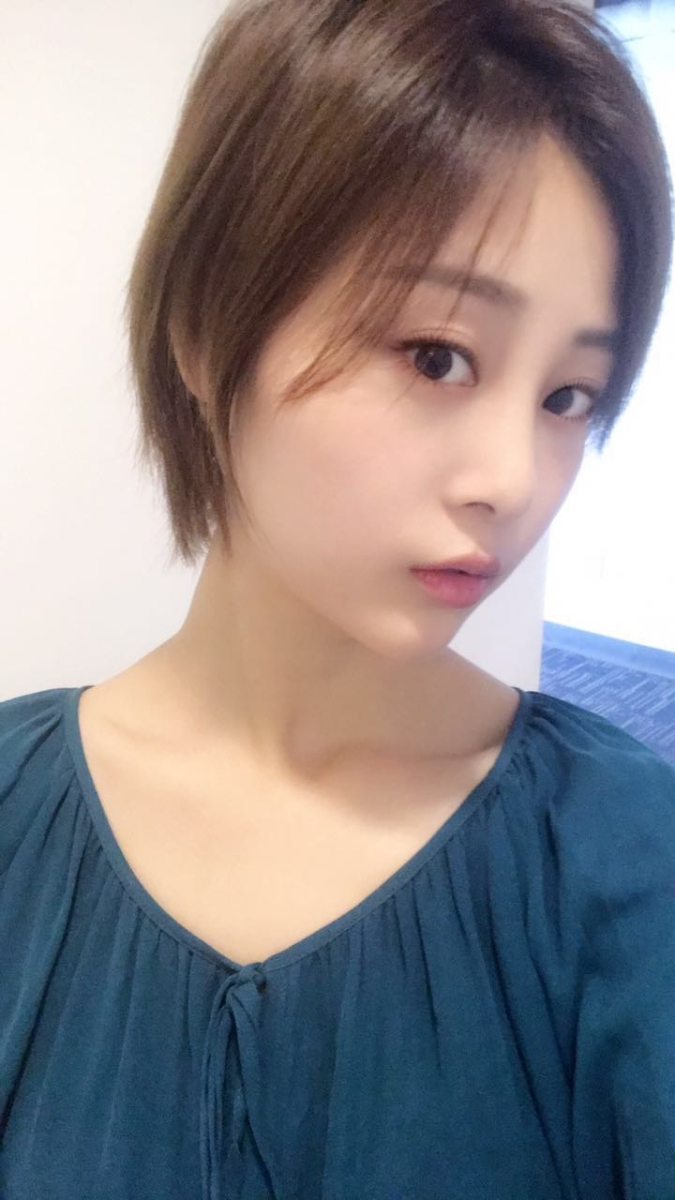 天津歐華威莎整形醫(yī)生姚玲做面部埋線提升效果怎么樣？附埋線提升案例