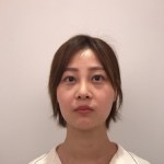 天津歐華威莎整形醫(yī)生姚玲做面部埋線提升效果怎么樣？附埋線提升案例