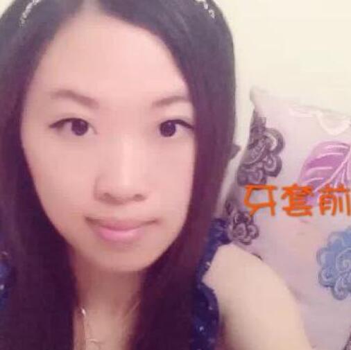重慶嘉悅口腔醫(yī)院周繼祥醫(yī)生做金屬托槽矯正效果怎么樣？附案例效果對比圖