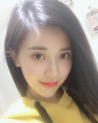 襄陽維多利亞整形醫(yī)院安邰晥醫(yī)生做鼻綜合整形怎么樣？附鼻綜合整形案例