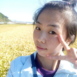 珠海蒂伊醫(yī)療整形醫(yī)生廖俊凱做激光祛斑效果怎么樣？附激光祛斑案例效果圖