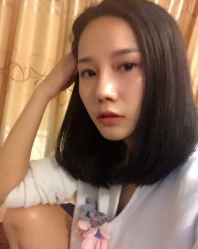 西安陽光整形醫(yī)院邵萍醫(yī)生做鼻綜合整形怎么樣？附鼻綜合整形案例