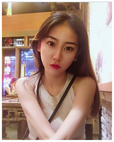 珠海海大整形美容外科黃發(fā)醫(yī)生做面部吸脂怎么樣？附面部吸脂案例