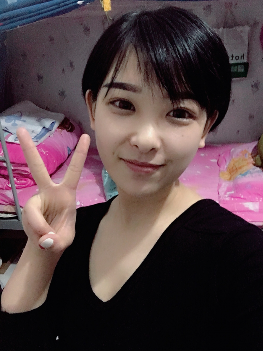 武漢肽慕醫(yī)美整形醫(yī)院楊婉菱醫(yī)生做面部吸脂效果怎么樣？附面部吸脂案例