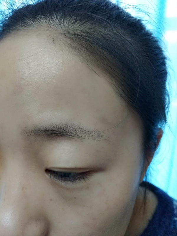 長沙愛思特醫(yī)療美容醫(yī)院做半永久紋眉怎么樣？附彭子娟醫(yī)生案例效果圖