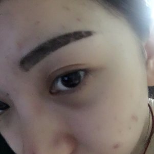 大同清木整形醫(yī)院張樹霞醫(yī)生做半永久紋眉效果如何？附半永久紋眉效果圖
