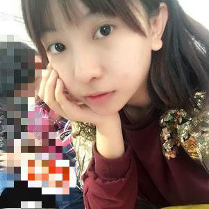大同清木整形醫(yī)院張樹霞醫(yī)生做半永久紋眉效果如何？附半永久紋眉效果圖
