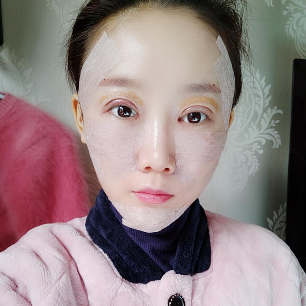 上海首爾麗格整形醫(yī)院醫(yī)生唐鏖做眼綜合+自體脂肪全臉填充案例效果對(duì)比圖