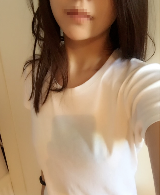 東莞韓美整形醫(yī)院醫(yī)生黃玉潔做假體隆胸怎么樣？附案例效果圖