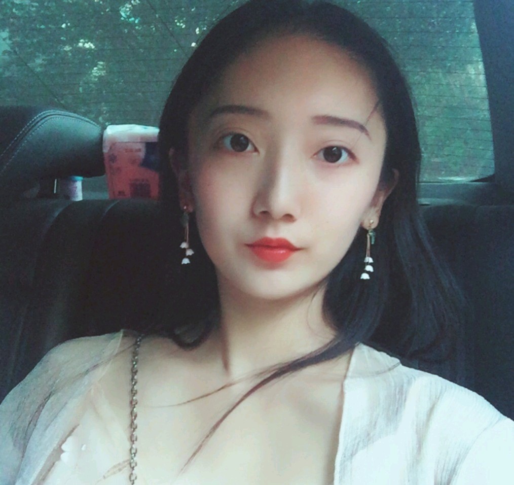 深圳鵬愛醫(yī)療美容醫(yī)院醫(yī)生文炯軫做埋線隆鼻怎么樣？附案例