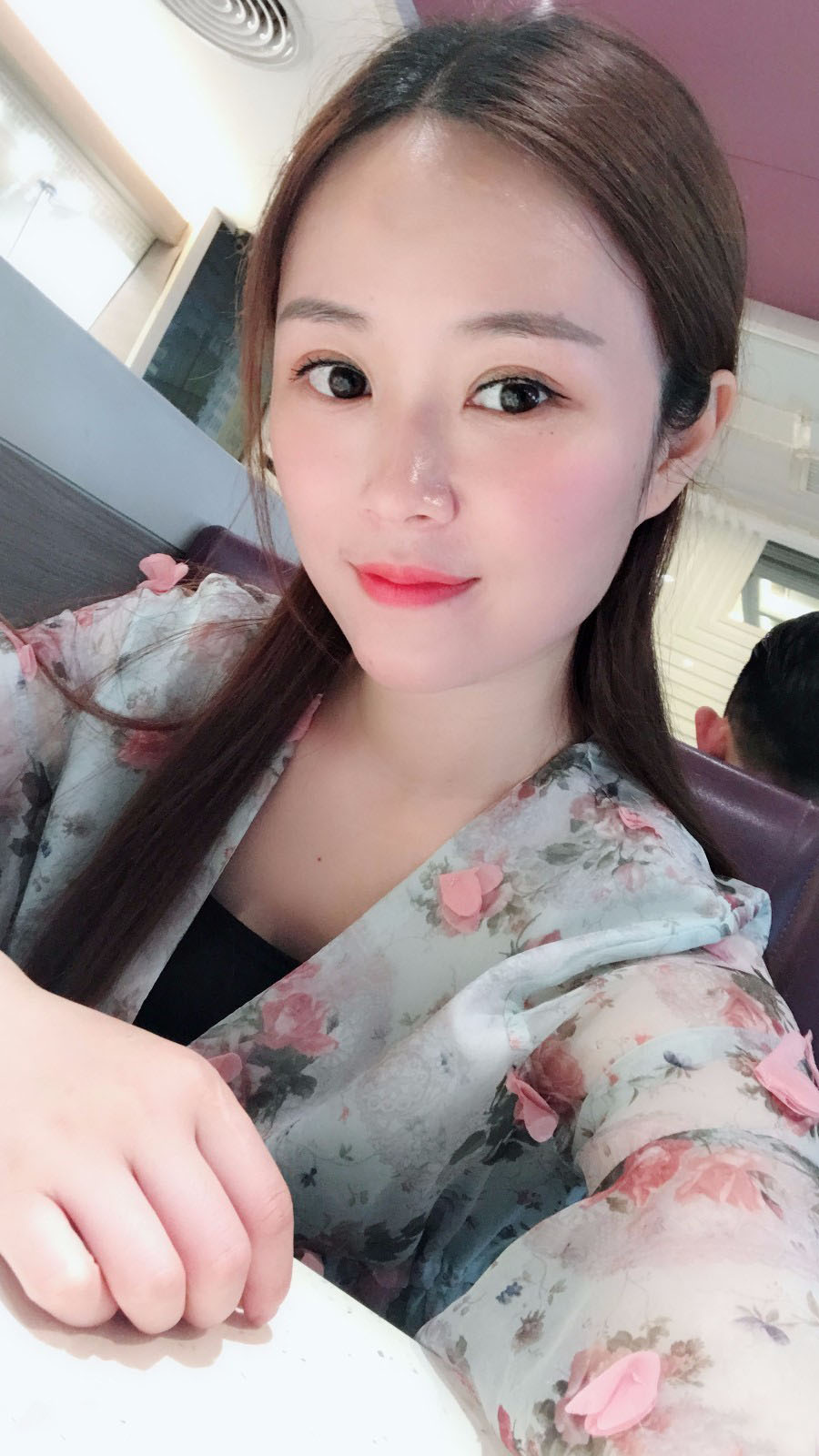 廣東韓妃醫(yī)療美容醫(yī)院做切開雙眼怎么樣？附案例效果圖