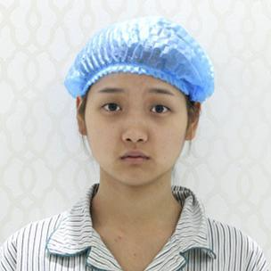 武漢伽美醫(yī)療美容醫(yī)院醫(yī)生鄭泰成做切開雙眼皮怎么樣？附案例