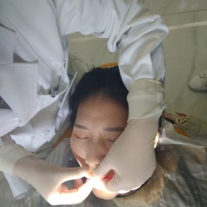 黔西南興義京州口腔醫(yī)院醫(yī)生徐勇做牙貼面怎么樣？附案例效果對比圖
