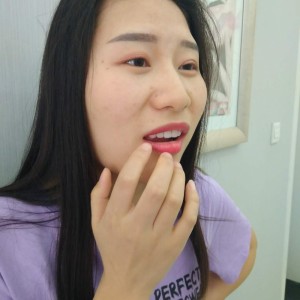 洛陽友好口腔醫(yī)院醫(yī)生李新然做牙貼面怎么樣？附案例效果圖