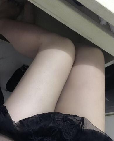 上海保加醫(yī)療美容門診部做大腿吸脂怎么樣？附楊勇醫(yī)生案例效果對比圖