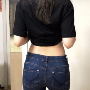 北京可思美整形醫(yī)院醫(yī)生斯勤做腰腹吸脂怎么樣？附案例效果對比圖