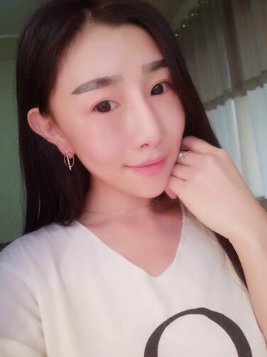 貴陽(yáng)泰康樂(lè)醫(yī)院整形美容科醫(yī)生陳璐做自體脂肪全臉填充效果怎么樣？