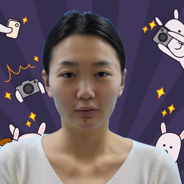 杭州格萊美整形美容醫(yī)院醫(yī)生張霞飛做自體脂肪全臉填充效果怎么樣？