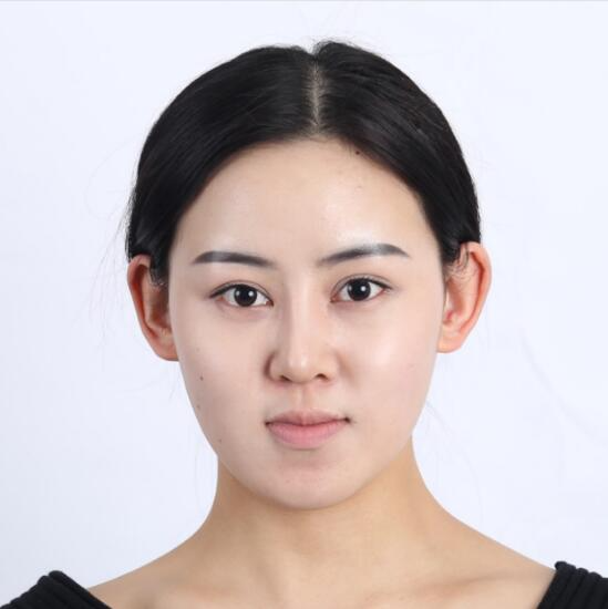 上海時(shí)光整形外科醫(yī)院醫(yī)生李靜林做假體隆鼻和反頜手術(shù)怎么樣？