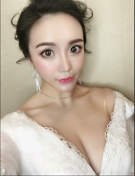 重慶當(dāng)代整形美容醫(yī)院醫(yī)生楊健做假體隆胸怎么樣？附案例
