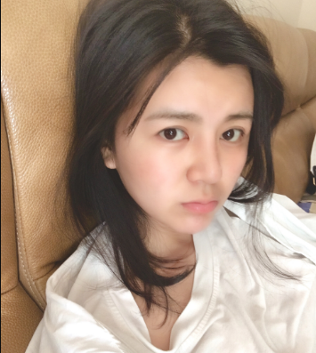 上海時光整形外科醫(yī)院醫(yī)生何晉龍做假體隆胸怎么樣？附案例效果對比圖