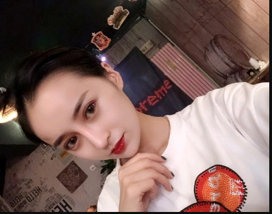 武漢米蘭醫(yī)療美容醫(yī)生柳再億做眼綜合+鼻綜合整形怎么樣？附真實案例對比圖