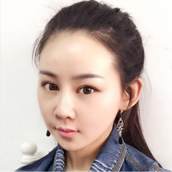 上海時(shí)光整形外科醫(yī)院醫(yī)生李靜林做假體隆鼻和反頜手術(shù)怎么樣？