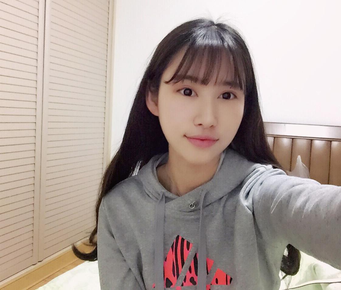 海南華美醫(yī)學(xué)美容醫(yī)院醫(yī)生潘磊做顴骨顴弓整形怎么樣？附案例效果對比圖