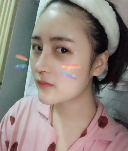 北京伊美爾美容愛康醫(yī)院醫(yī)生柳成做鼻綜合整形怎么樣？附案例效果圖
