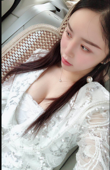吉林現(xiàn)代整形美容醫(yī)院做假體隆胸效果怎么樣？附醫(yī)院案例效果對比圖